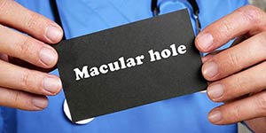 Macular Hole Treatment Near Me in Hamden, Norwalk, Trumbull, New Haven, Madison, and Fairfield CT 