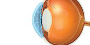 Intravitreal Injections Near Me in Hamden, Norwalk, Trumbull, New Haven, Madison, and Fairfield CT 